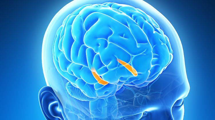 Der Hippocampus, hier in Orange dargestellt, schrumpft bei Alzheimer-Patientinnen und -Patienten. 